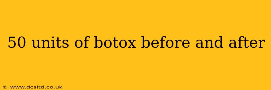 50 units of botox before and after