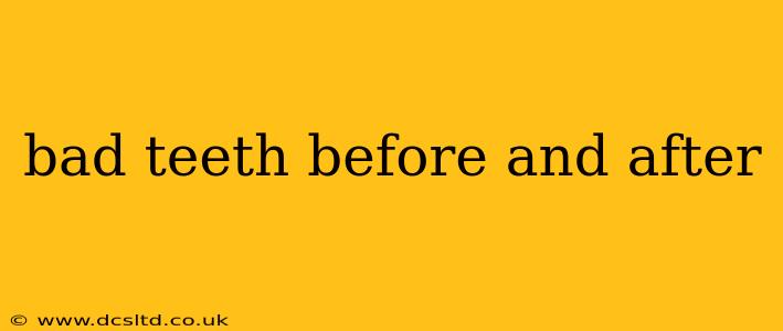 bad teeth before and after