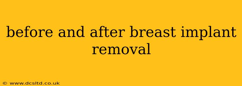 before and after breast implant removal