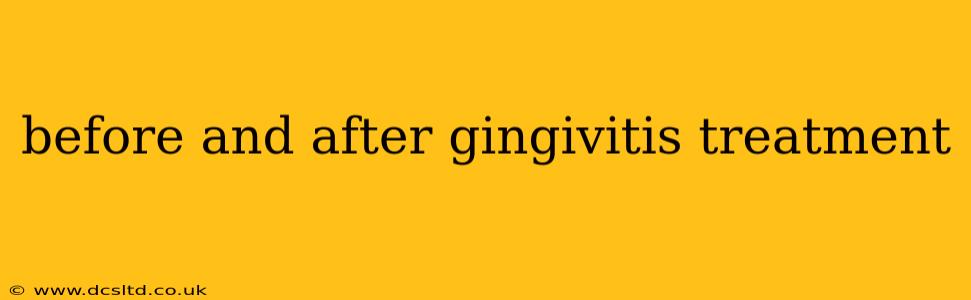 before and after gingivitis treatment
