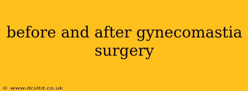 before and after gynecomastia surgery