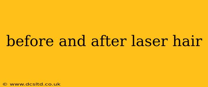 before and after laser hair
