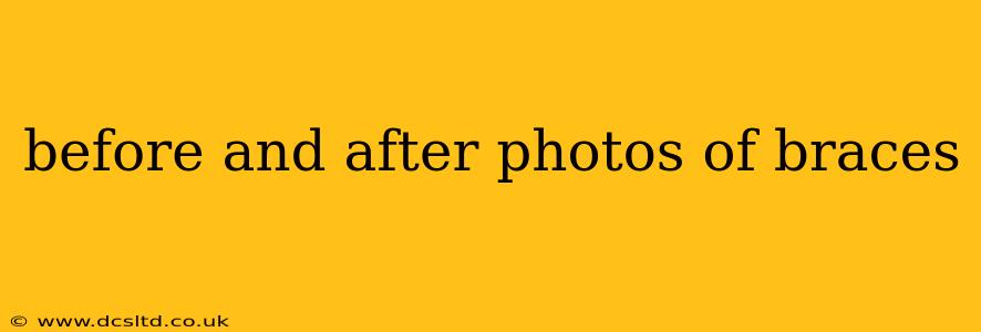 before and after photos of braces