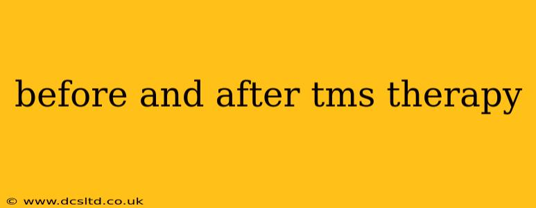before and after tms therapy