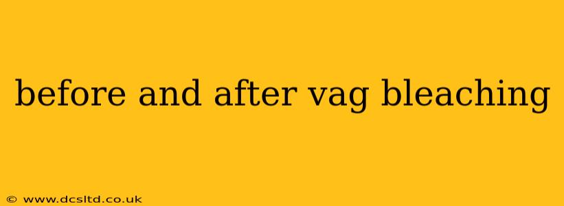 before and after vag bleaching