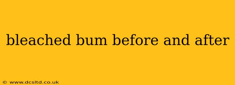 bleached bum before and after
