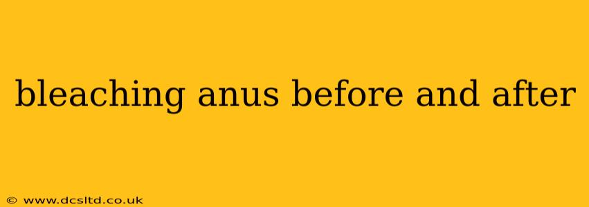 bleaching anus before and after