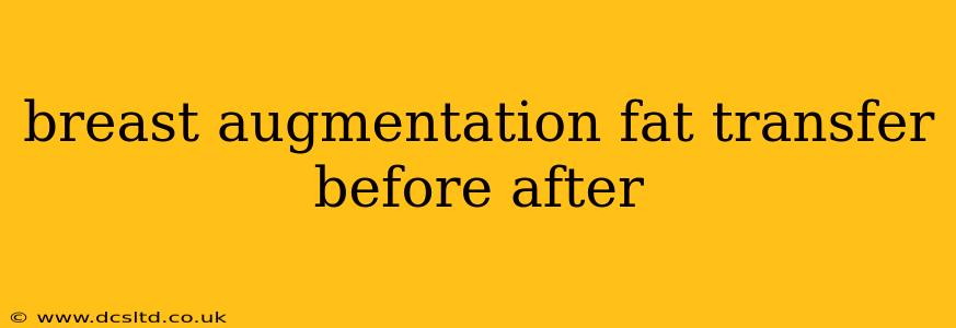 breast augmentation fat transfer before after