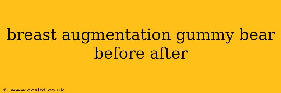 breast augmentation gummy bear before after