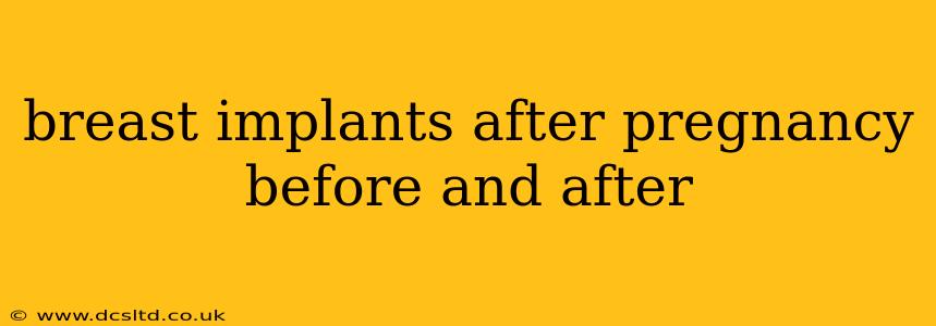 breast implants after pregnancy before and after
