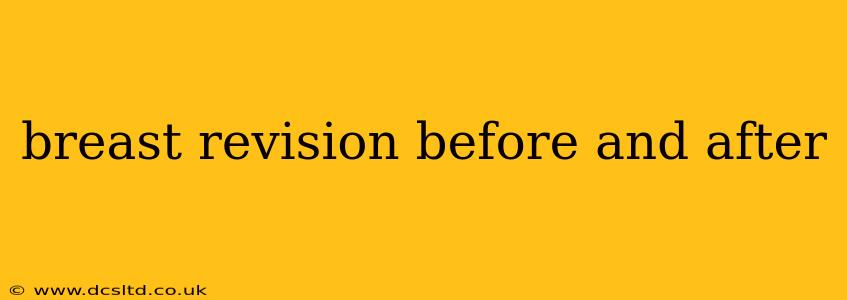 breast revision before and after