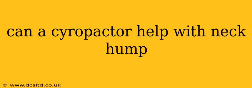 can a cyropactor help with neck hump