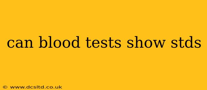 can blood tests show stds