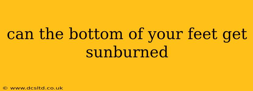 can the bottom of your feet get sunburned