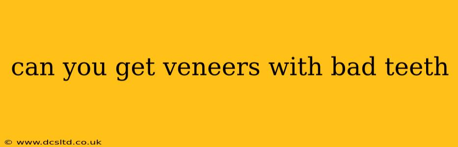 can you get veneers with bad teeth