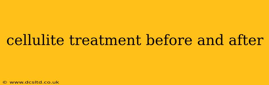 cellulite treatment before and after