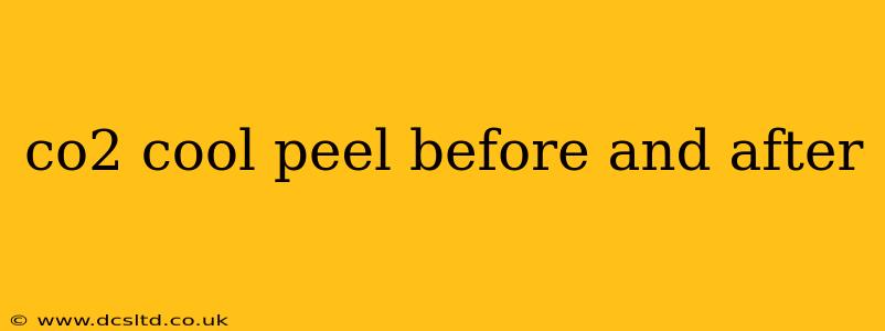 co2 cool peel before and after