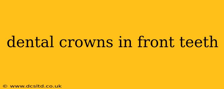 dental crowns in front teeth