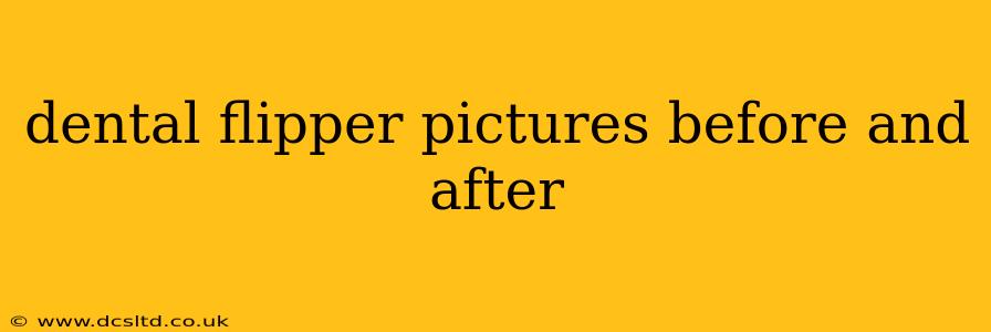 dental flipper pictures before and after