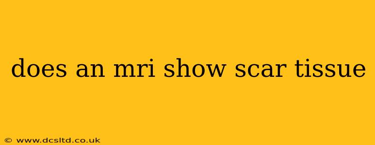 does an mri show scar tissue