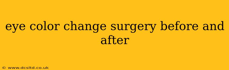 eye color change surgery before and after