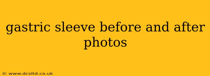 gastric sleeve before and after photos
