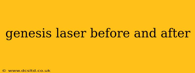 genesis laser before and after