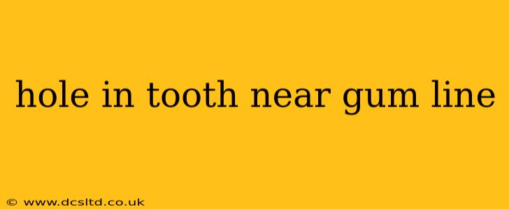 hole in tooth near gum line