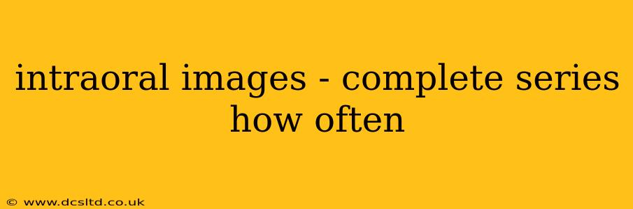 intraoral images - complete series how often