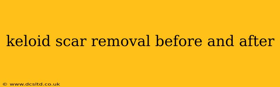 keloid scar removal before and after
