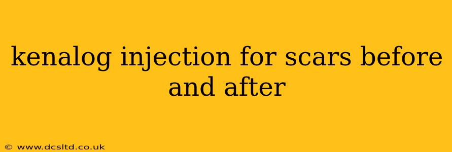 kenalog injection for scars before and after