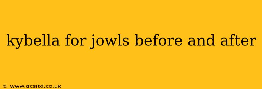 kybella for jowls before and after