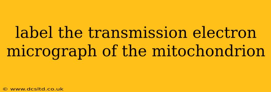 label the transmission electron micrograph of the mitochondrion
