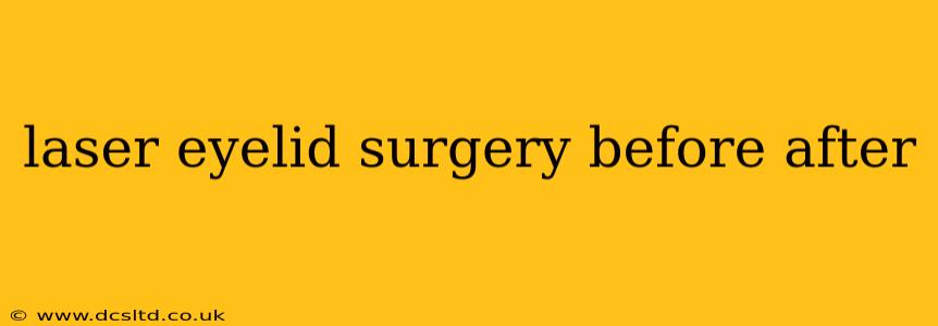 laser eyelid surgery before after