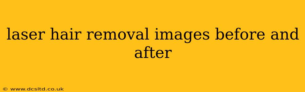 laser hair removal images before and after