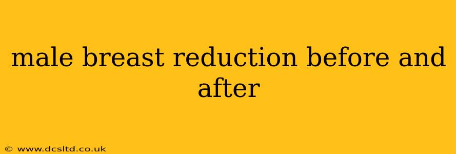 male breast reduction before and after