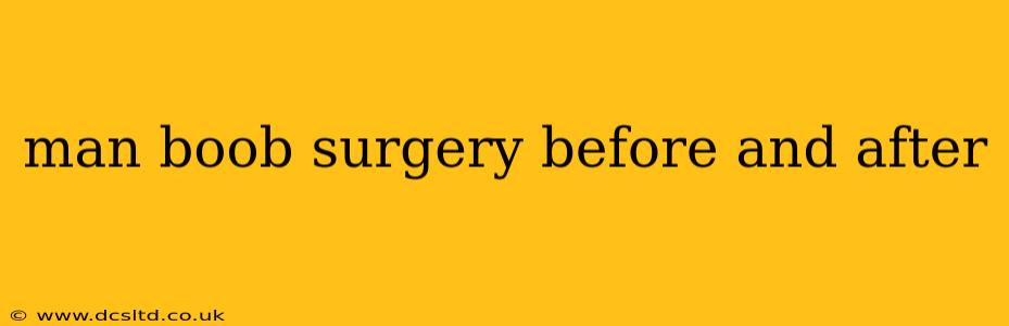 man boob surgery before and after