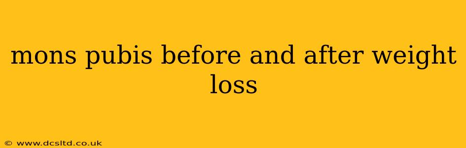 mons pubis before and after weight loss