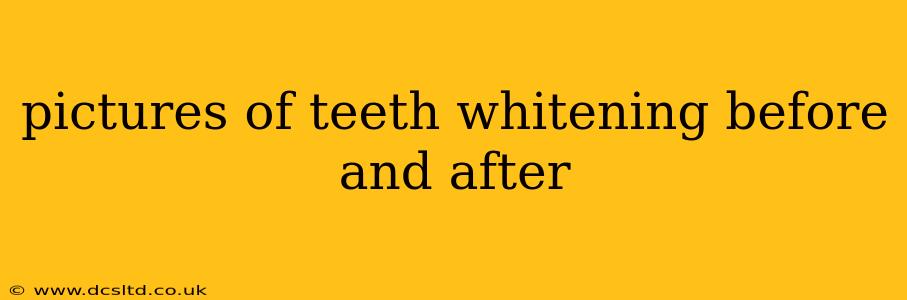 pictures of teeth whitening before and after
