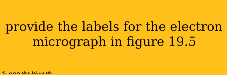 provide the labels for the electron micrograph in figure 19.5 provide the labels for the electron micrograph in figure 19.5