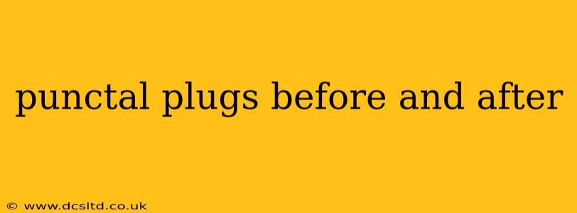 punctal plugs before and after