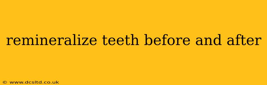 remineralize teeth before and after