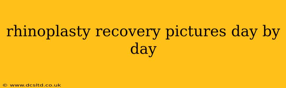 rhinoplasty recovery pictures day by day