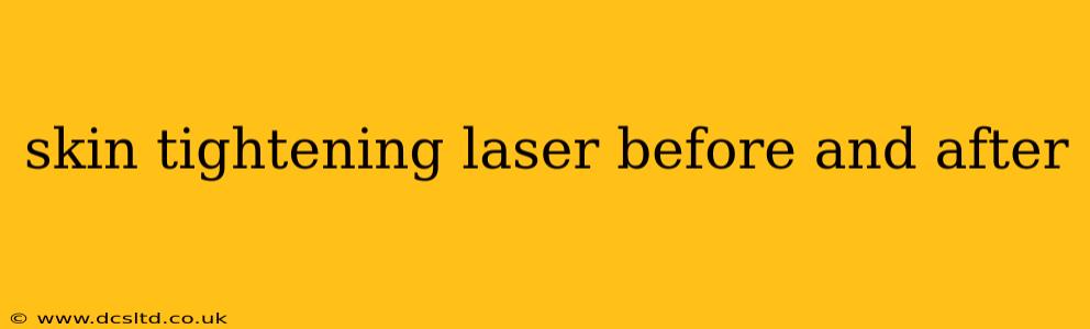 skin tightening laser before and after