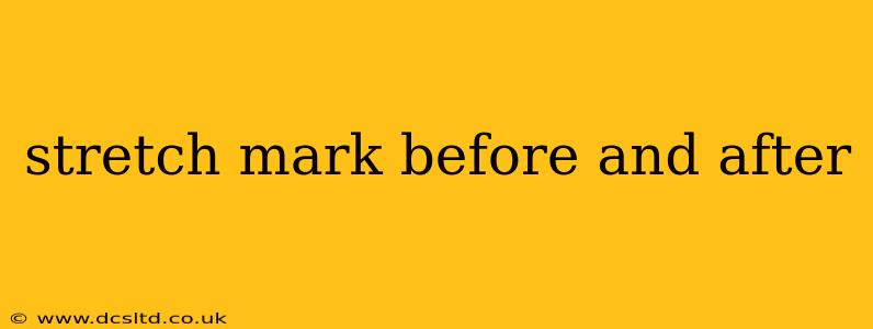 stretch mark before and after