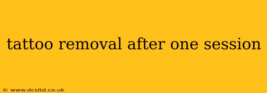 tattoo removal after one session