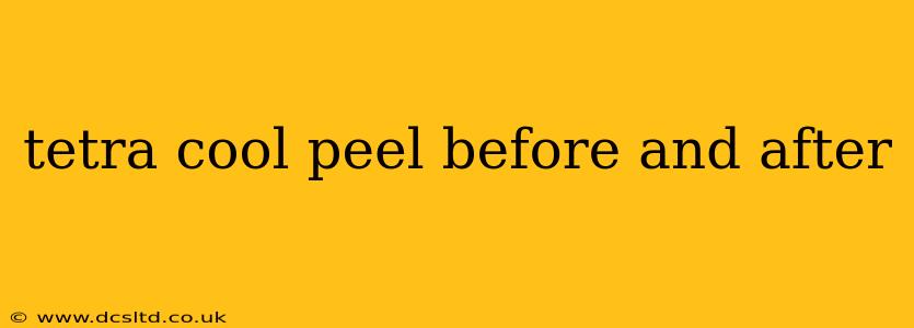 tetra cool peel before and after