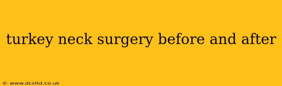 turkey neck surgery before and after