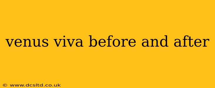 venus viva before and after