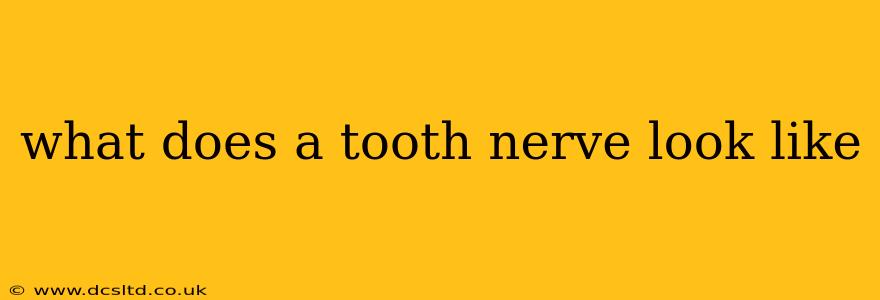 what does a tooth nerve look like
